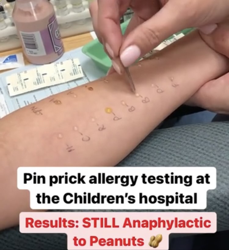 Children and Anaphylaxis